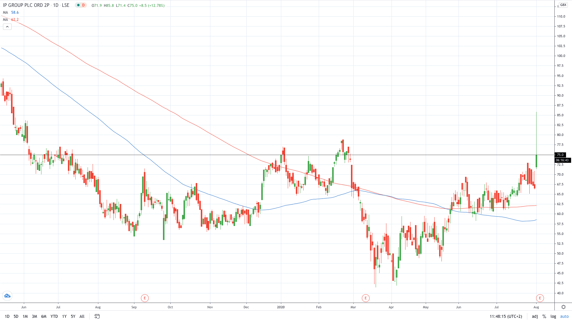 IP Group share price soars 30% on new COVID-10 tests August 2020 