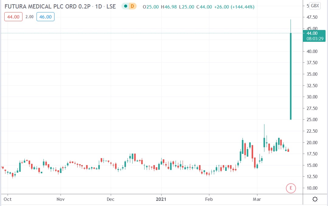 Tradingview chart of Futura Medical share price 19-03-2021